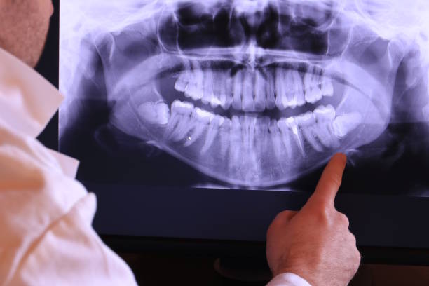 Best Dental Abscess Treatment in New Paris, OH